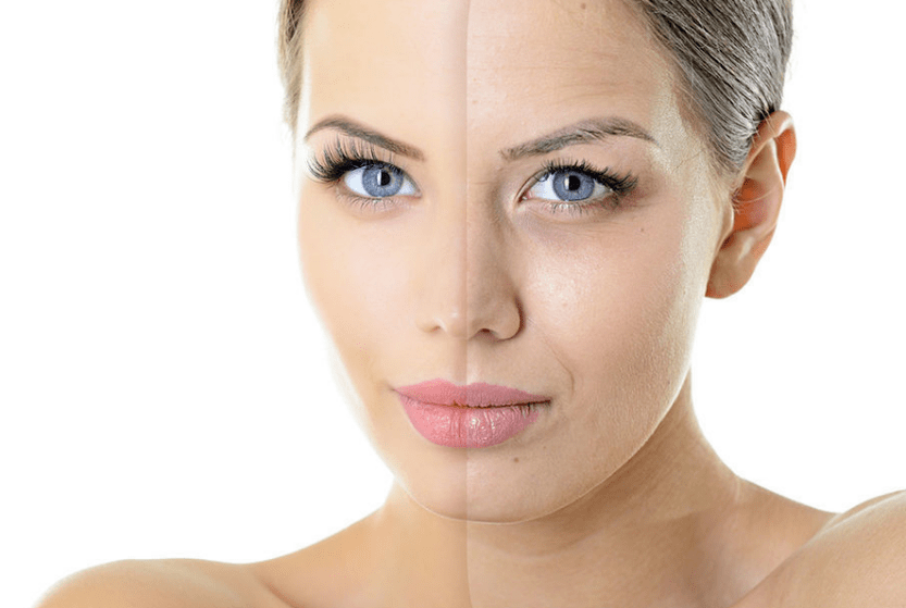 Face rejuvenation