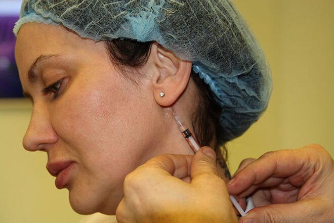 Facial oval correction with fillers