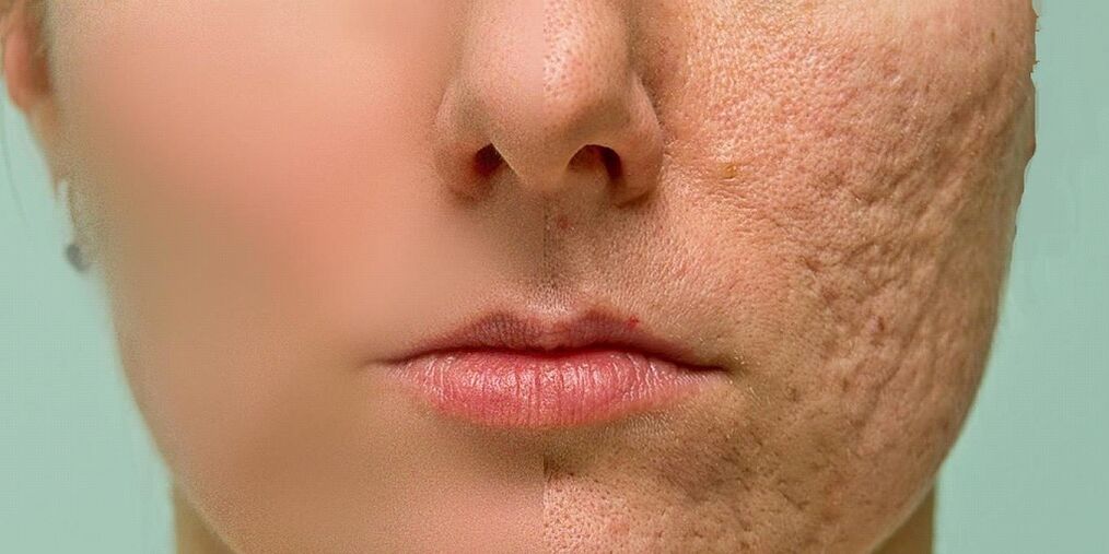 Indications for the rejuvenation procedure