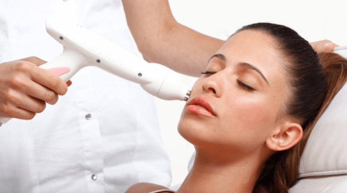 Face laser rejuvenation