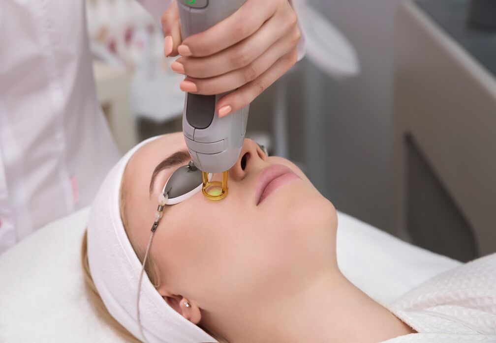 How laser rejuvenation of the skin around the eyes is performed