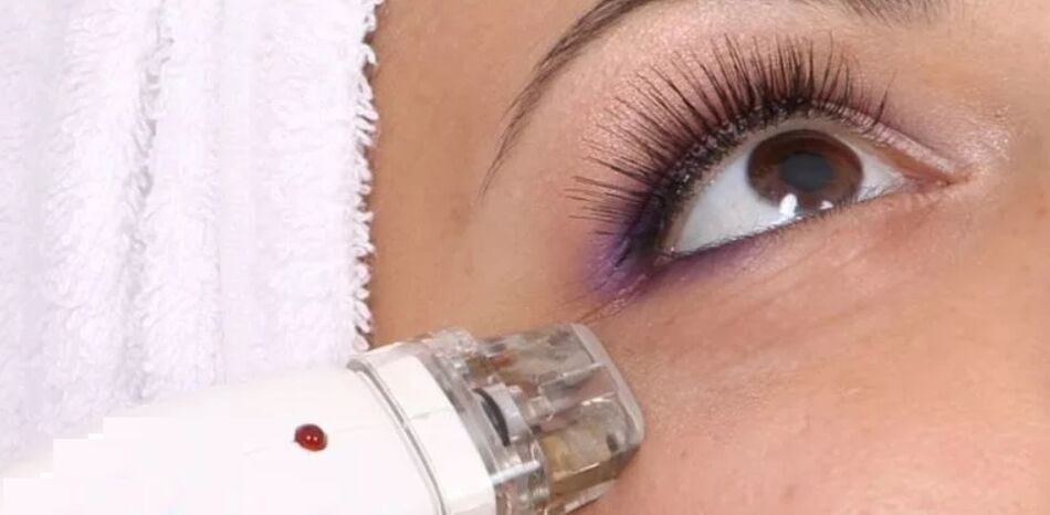 High temperature rejuvenation technique