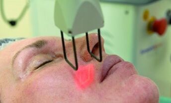 performing fractional laser rejuvenation procedures
